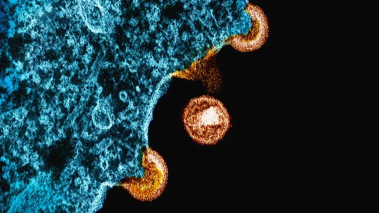 Micrografía del virus VIH atacando una célula humana en detalle.