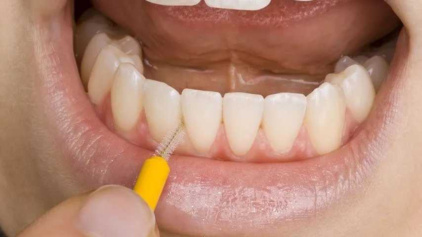 Una persona utilizando un cepillo interdental. (Foto: Wikimedia)