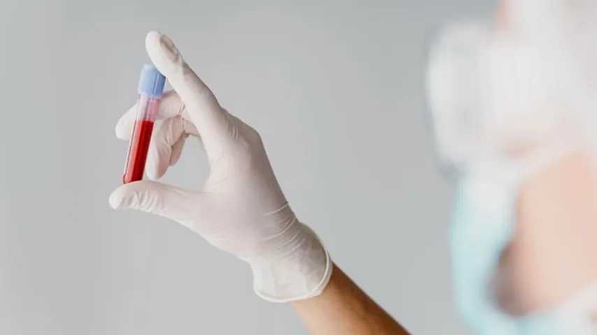 Personal sanitario con una muestra de sangre en un vial de extracción sanguínea. (Foto: Freepik)